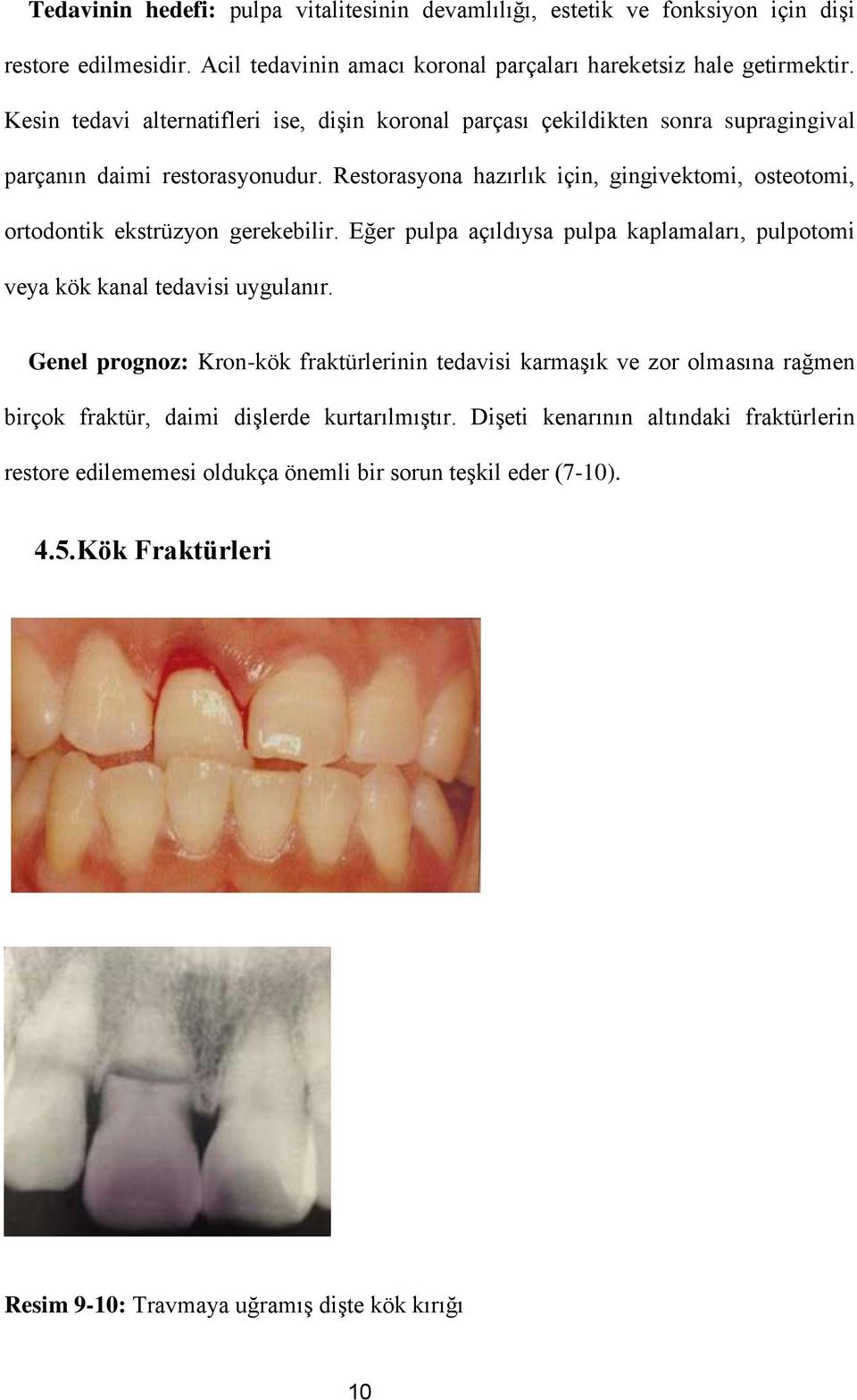 Restorasyona hazırlık için, gingivektomi, osteotomi, ortodontik ekstrüzyon gerekebilir. Eğer pulpa açıldıysa pulpa kaplamaları, pulpotomi veya kök kanal tedavisi uygulanır.