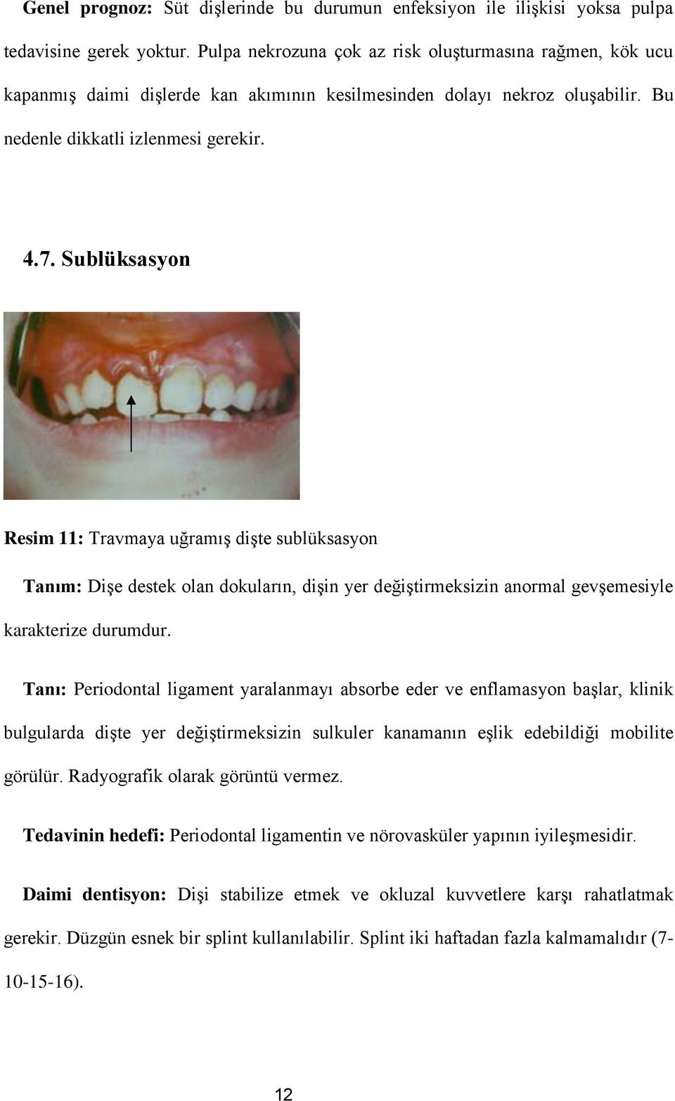 Sublüksasyon Resim 11: Travmaya uğramış dişte sublüksasyon Tanım: Dişe destek olan dokuların, dişin yer değiştirmeksizin anormal gevşemesiyle karakterize durumdur.