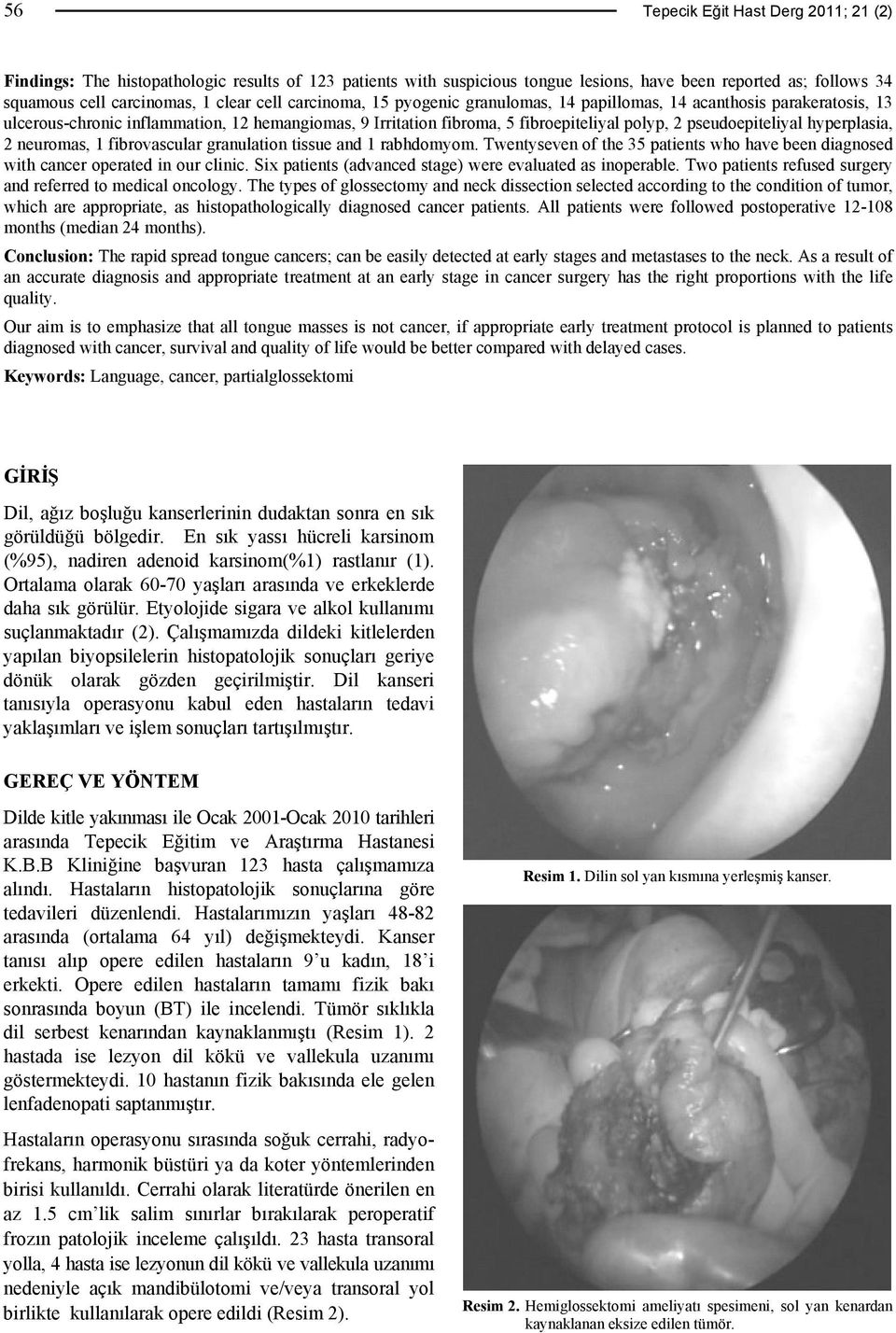 hyperplasia, 2 neuromas, 1 fibrovascular granulation tissue and 1 rabhdomyom. Twentyseven of the 35 patients who have been diagnosed with cancer operated in our clinic.