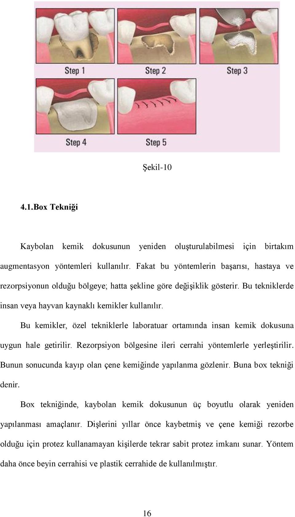 Bu kemikler, özel tekniklerle laboratuar ortamında insan kemik dokusuna uygun hale getirilir. Rezorpsiyon bölgesine ileri cerrahi yöntemlerle yerleştirilir.