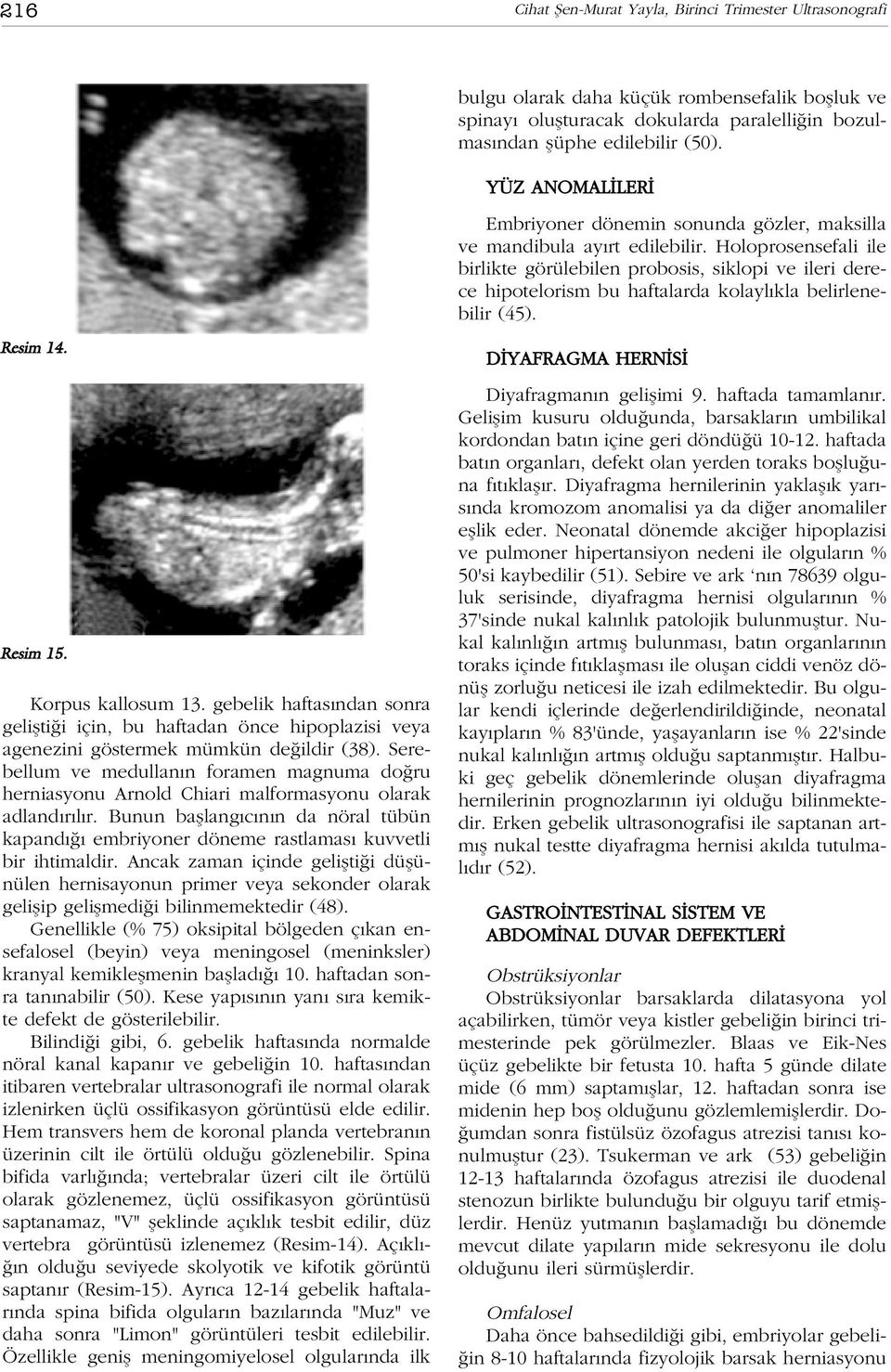 Holoprosensefali ile birlikte görülebilen probosis, siklopi ve ileri derece hipotelorism bu haftalarda kolayl kla belirlenebilir (45). Resim 14. Resim 15. Korpus kallosum 13.