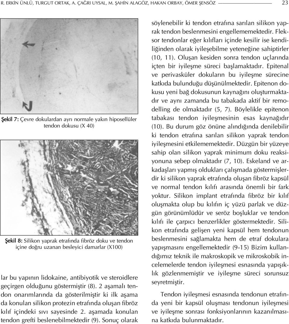 besleyici damarlar (X100) lar bu yapının lidokaine, antibiyotik ve steroidlere geçirgen olduğunu göstermiştir (8).