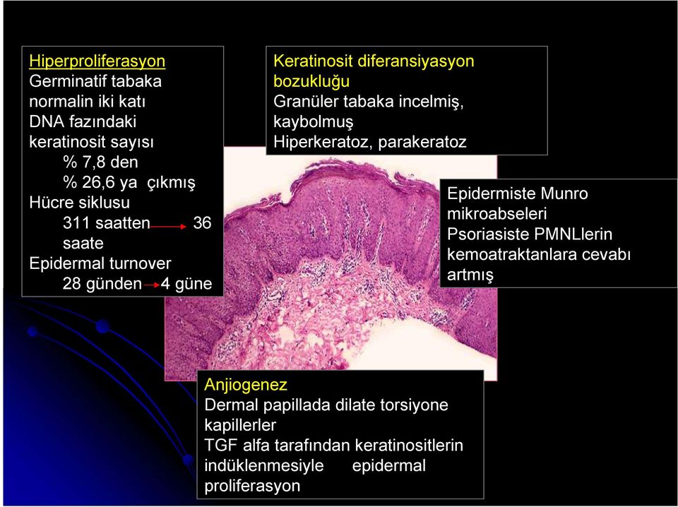 incelmiş, kaybolmuş Hiperkeratoz, parakeratoz Epidermiste Munro mikroabseleri Psoriasiste PMNLlerin kemoatraktanlara cevabı