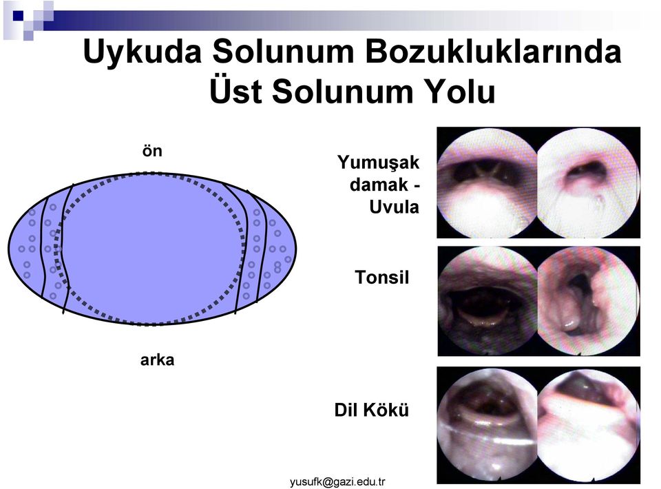 Solunum Yolu ön Yumuşak