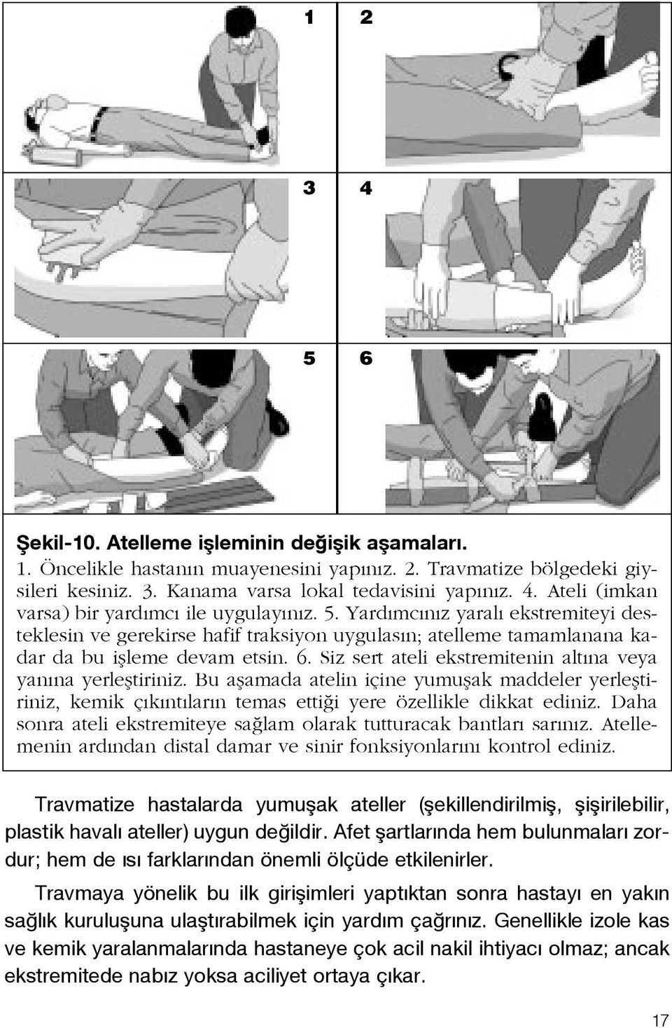 Siz sert ateli ekstremitenin alt na veya yan na yerlefltiriniz. Bu aflamada atelin içine yumuflak maddeler yerlefltiriniz, kemik ç k nt lar n temas etti i yere özellikle dikkat ediniz.