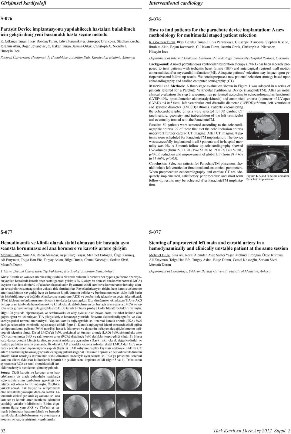 restoration therapy (PRT) has been recently proposed to treat patients ith ischemic heart failure () and anteroapical regional all motion abnormalities after myocardial infarction (M) Adeuate