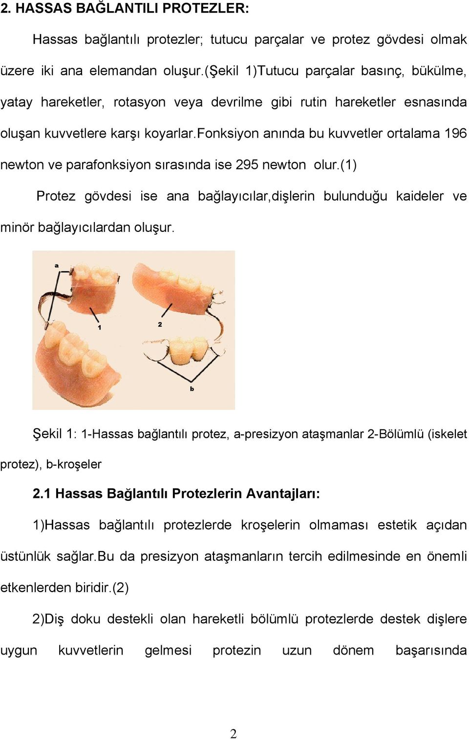 fonksiyon anında bu kuvvetler ortalama 196 newton ve parafonksiyon sırasında ise 295 newton olur.(1) Protez gövdesi ise ana bağlayıcılar,dişlerin bulunduğu kaideler ve minör bağlayıcılardan oluşur.