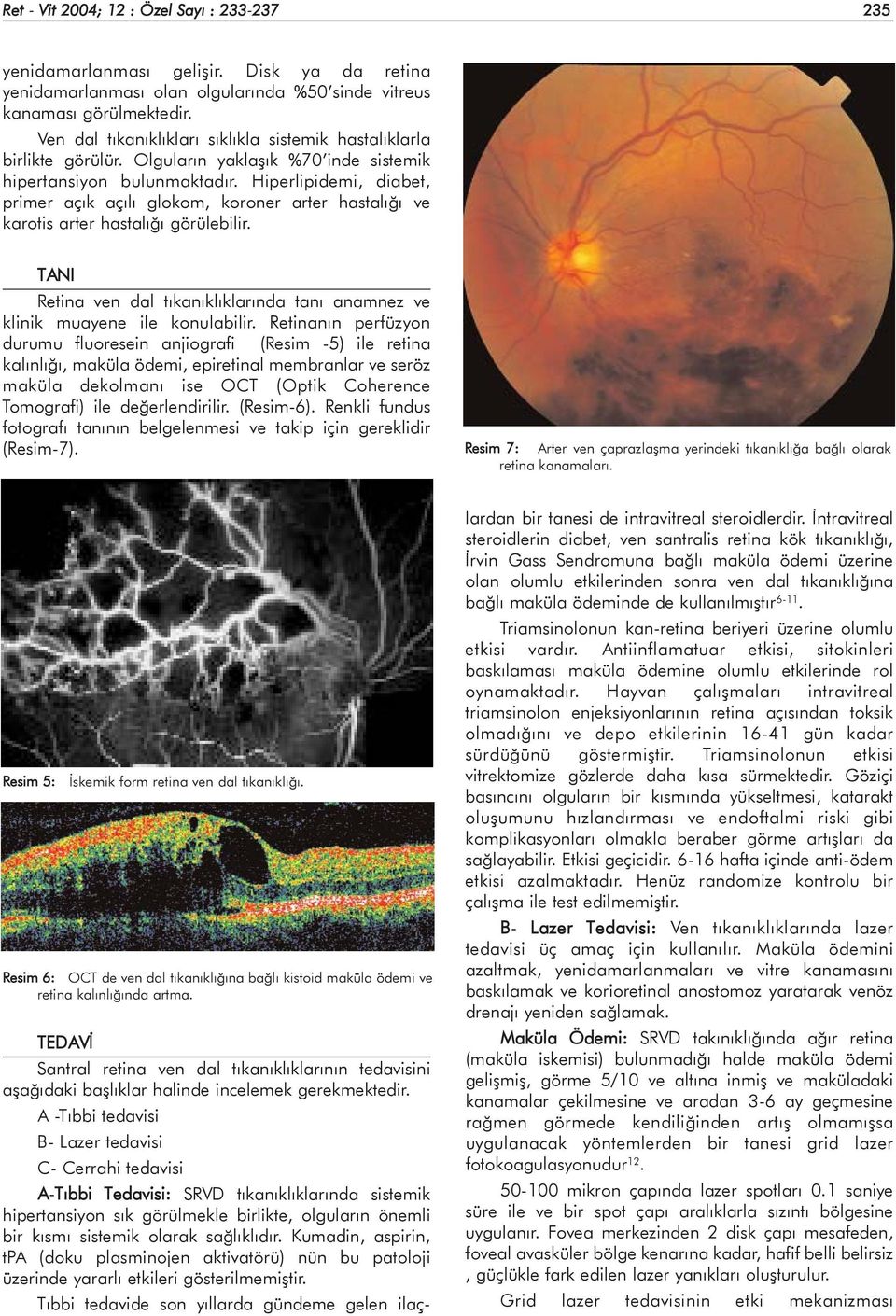 Hiperlipidemi, diabet, primer açýk açýlý glokom, koroner arter hastalýðý ve karotis arter hastalýðý görülebilir. TANI Retina ven dal týkanýklýklarýnda taný anamnez ve klinik muayene ile konulabilir.