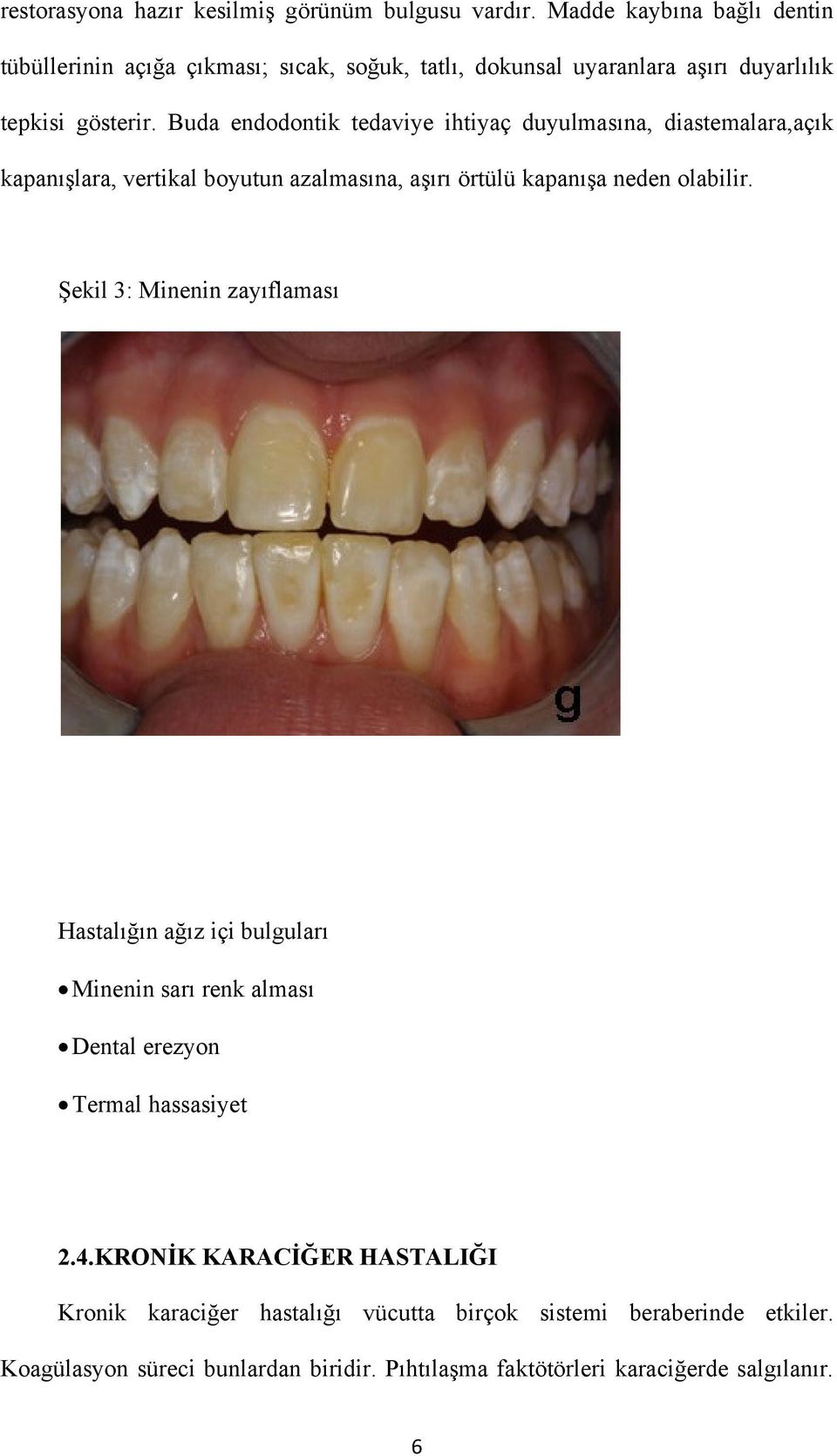 Buda endodontik tedaviye ihtiyaç duyulmasına, diastemalara,açık kapanışlara, vertikal boyutun azalmasına, aşırı örtülü kapanışa neden olabilir.