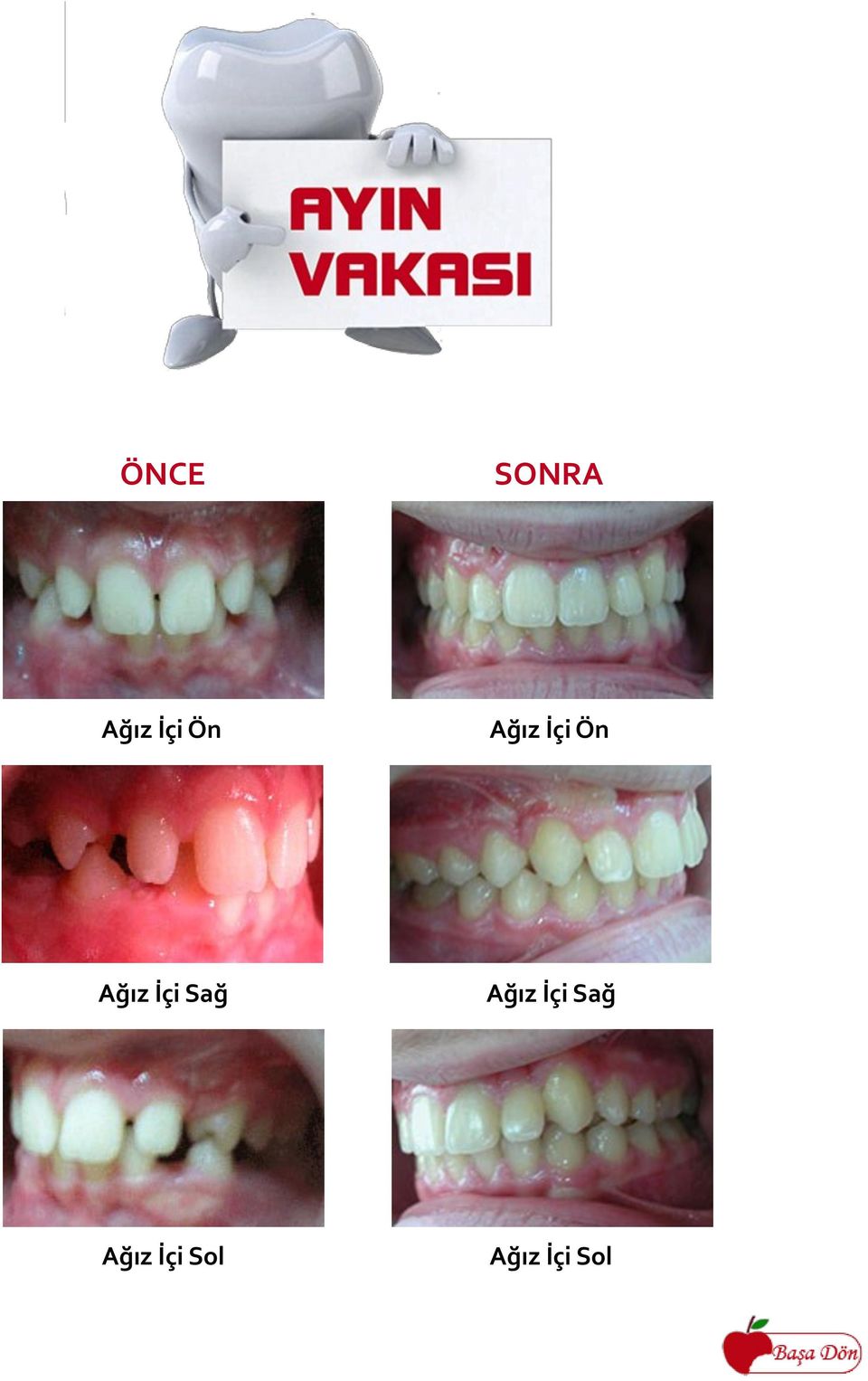 İçi Sağ Ağız İçi Sağ