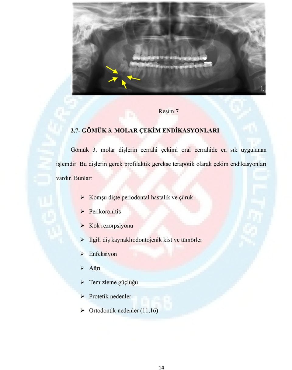 Bu dişlerin gerek profilaktik gerekse terapötik olarak çekim endikasyonları vardır.