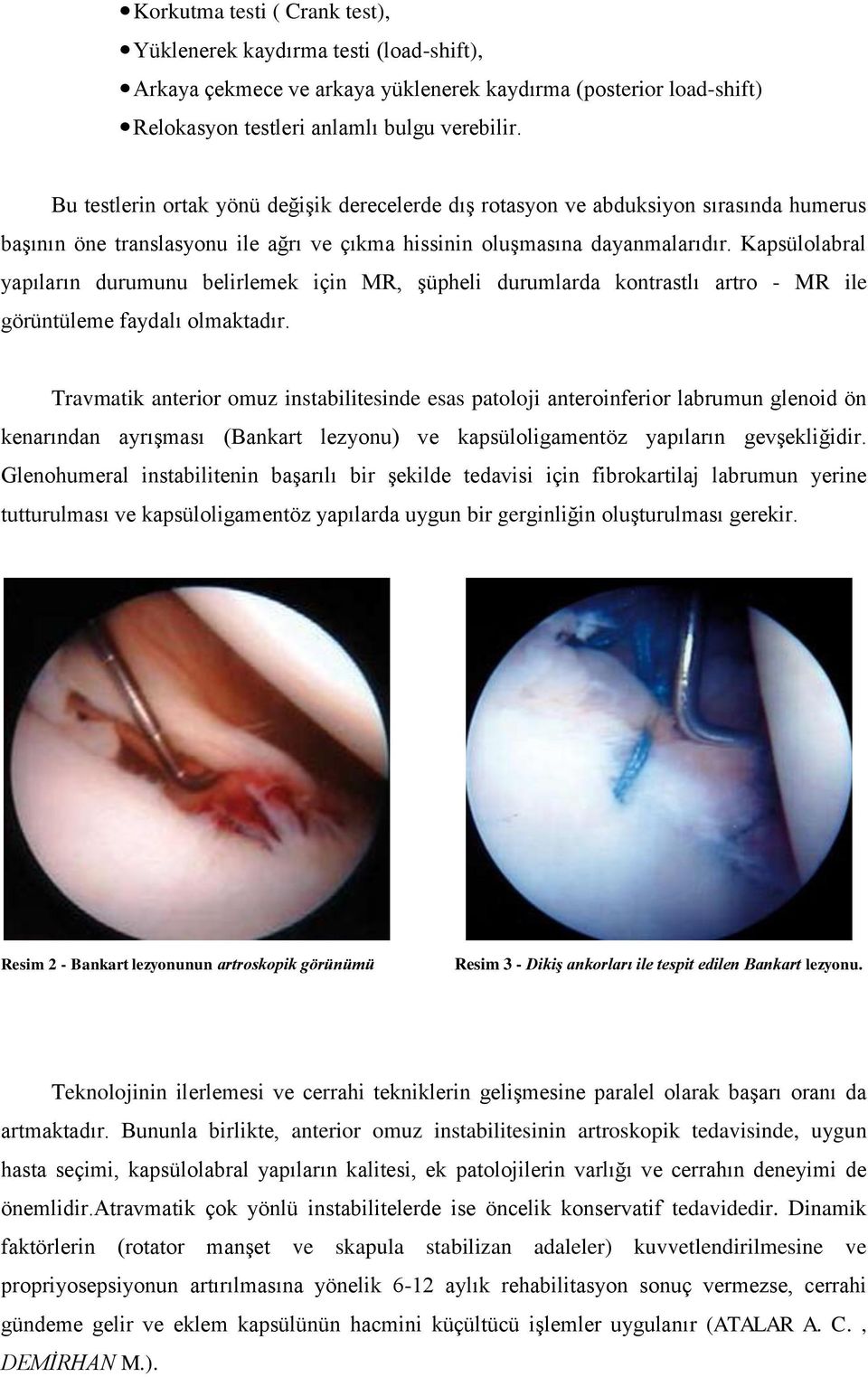 Kapsülolabral yapıların durumunu belirlemek için MR, şüpheli durumlarda kontrastlı artro - MR ile görüntüleme faydalı olmaktadır.