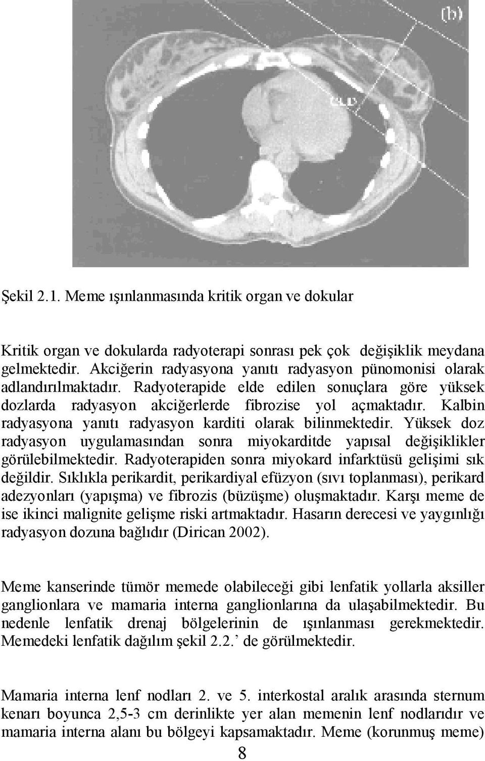 Kalbin radyasyona yanıtı radyasyon karditi olarak bilinmektedir. Yüksek doz radyasyon uygulamasından sonra miyokarditde yapısal değişiklikler görülebilmektedir.