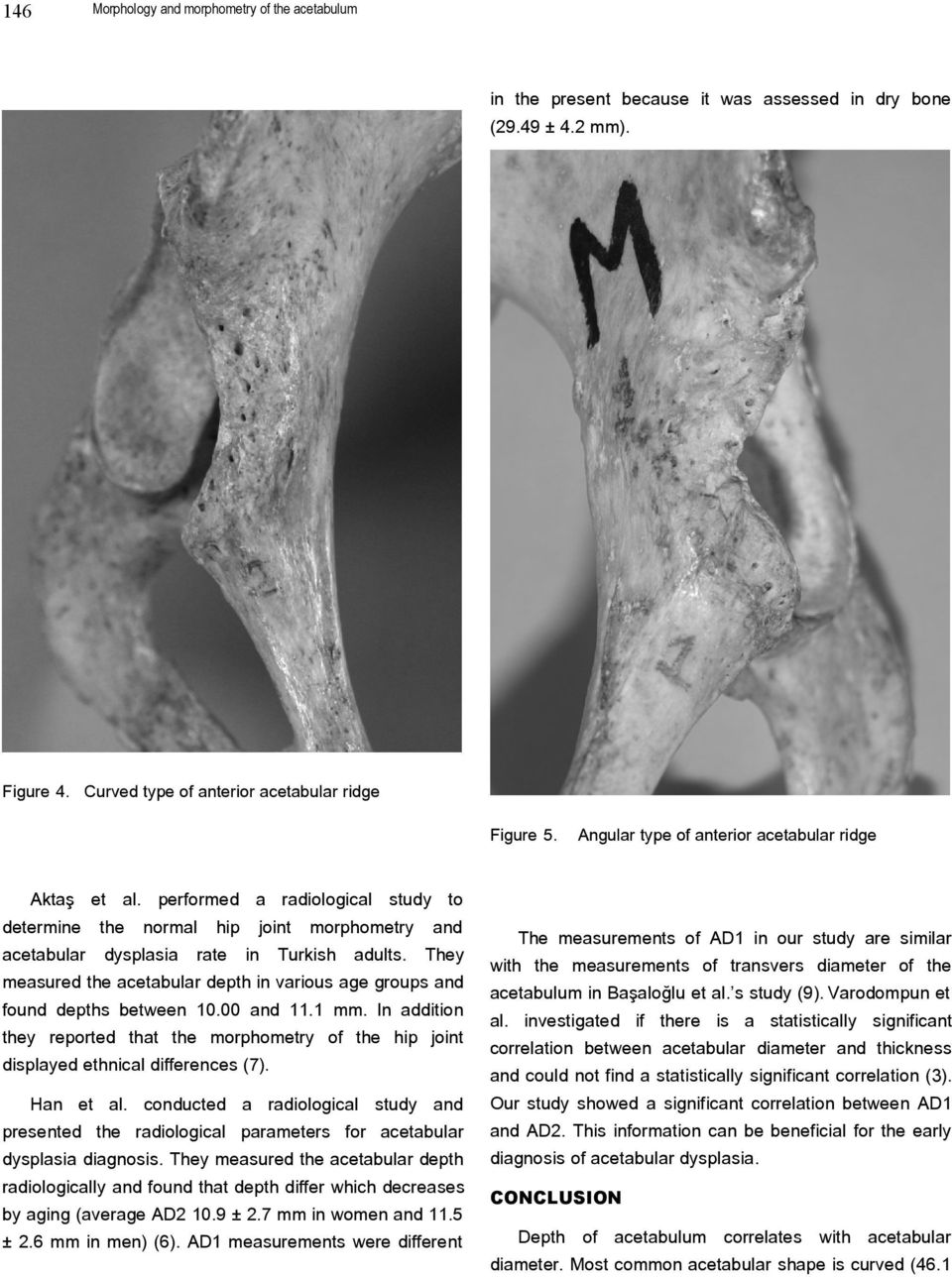 ad They measured the acetabular depth i various age groups ad foud depths betwee 10.00 ad 11.1 mm. I additio they reported that the morphometry of the hip joit displayed ethical differeces (7).