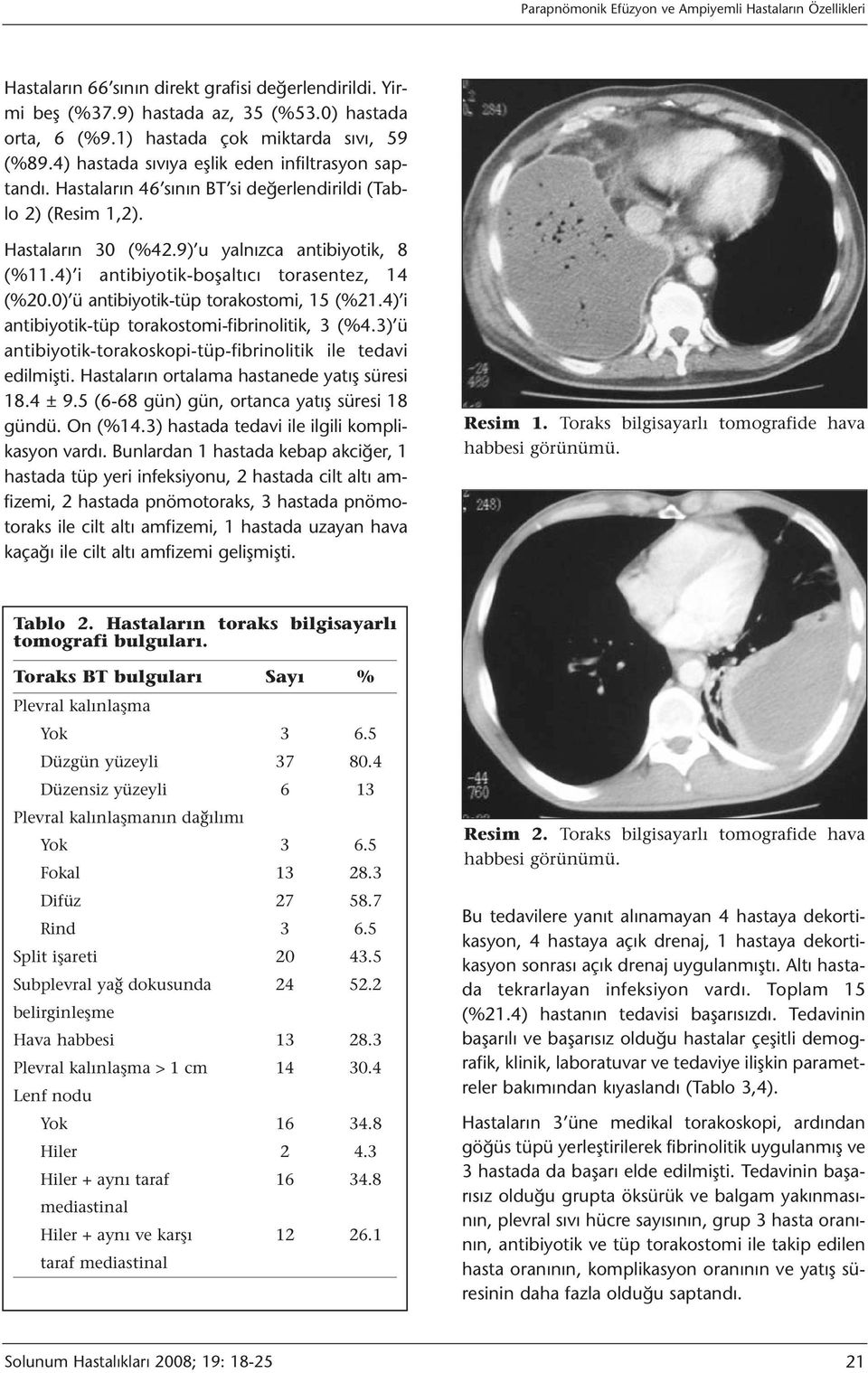 9) u yalnızca antibiyotik, 8 (%11.4) i antibiyotik-boşaltıcı torasentez, 14 (%20.0) ü antibiyotik-tüp torakostomi, 15 (%21.4) i antibiyotik-tüp torakostomi-fibrinolitik, 3 (%4.