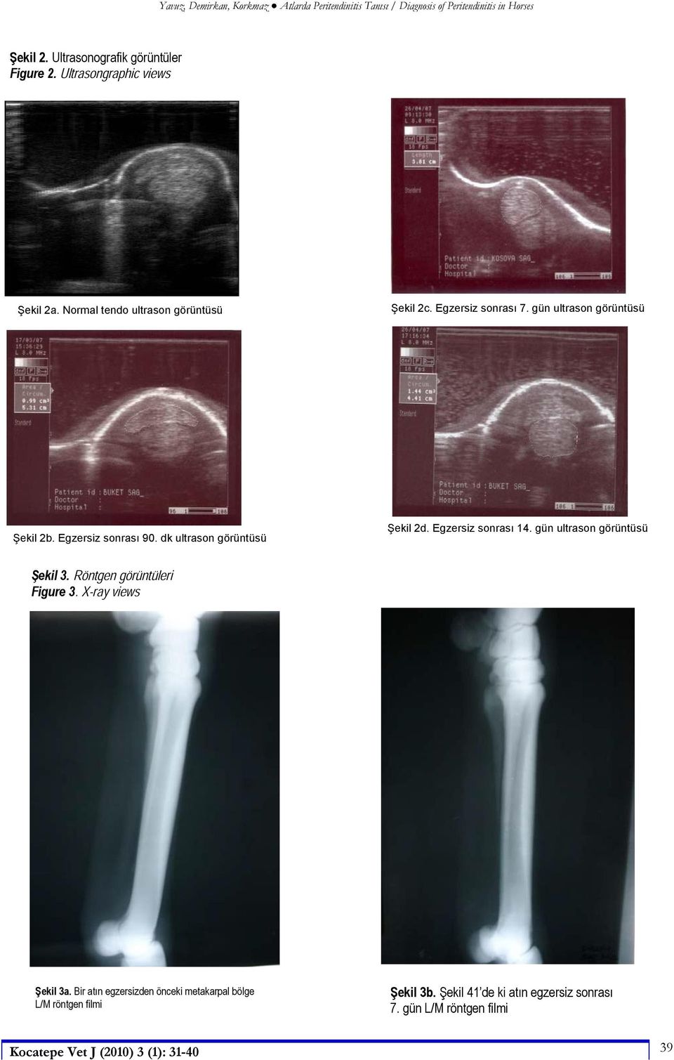 dk ultrason görüntüsü ekil 2d. Egzersiz sonras 14. gün ultrason görüntüsü ekil 3. Figure 3 ekil 3a.