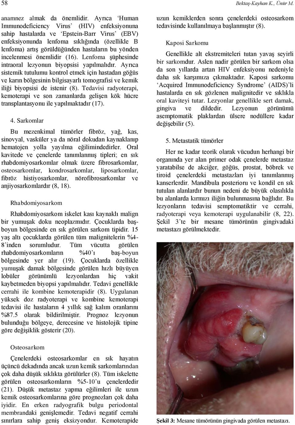 incelenmesi önemlidir (16). Lenfoma şüphesinde intraoral lezyonun biyopsisi yapılmalıdır.
