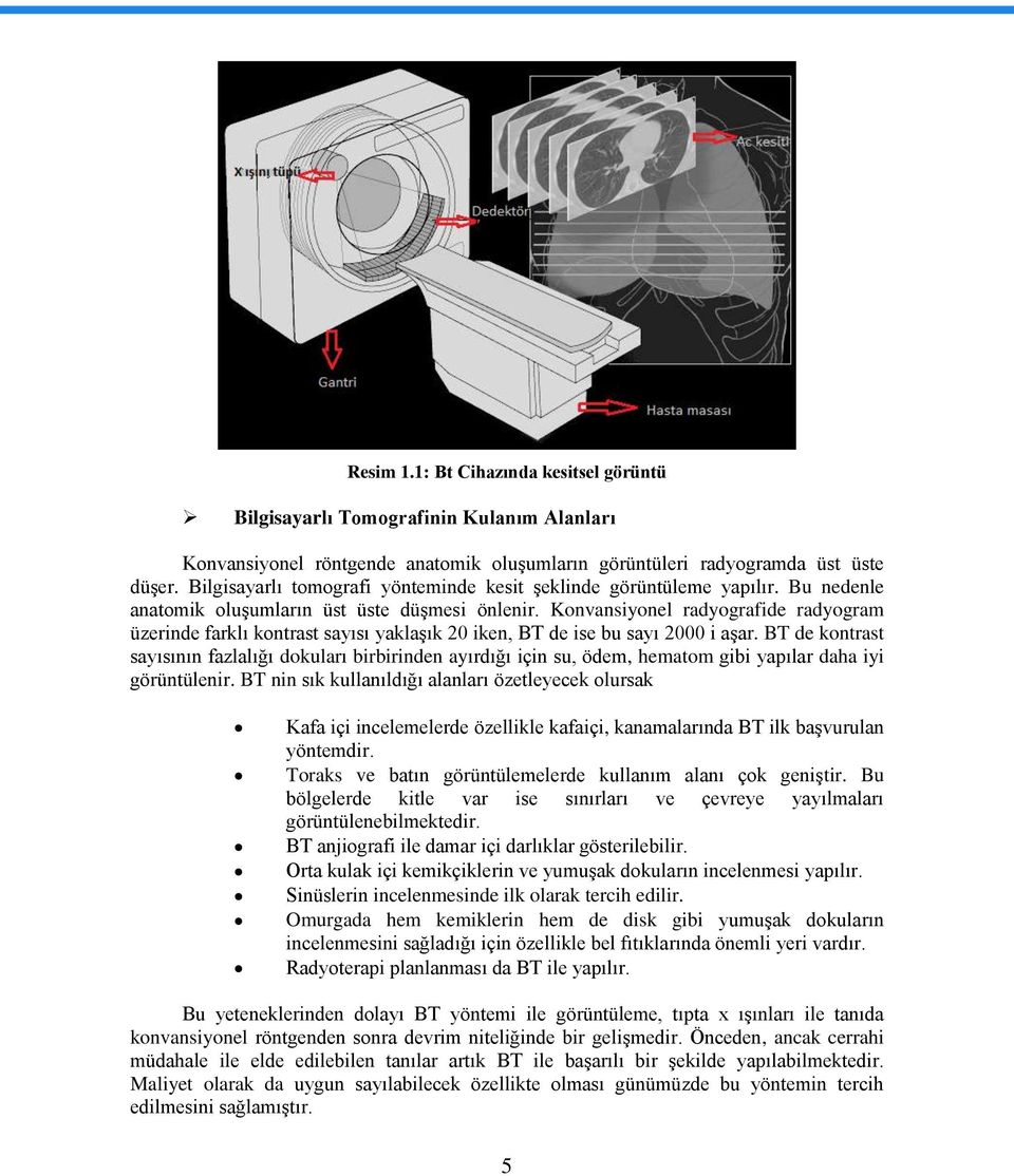 Konvansiyonel radyografide radyogram üzerinde farklı kontrast sayısı yaklaģık 20 iken, BT de ise bu sayı 2000 i aģar.
