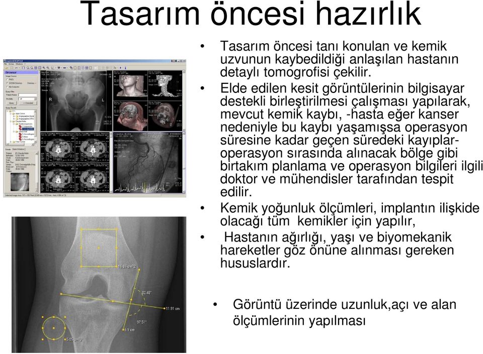 süresine kadar geçen süredeki kayıplaroperasyon sırasında alınacak bölge gibi birtakım planlama ve operasyon bilgileri ilgili doktor ve mühendisler tarafından tespit edilir.