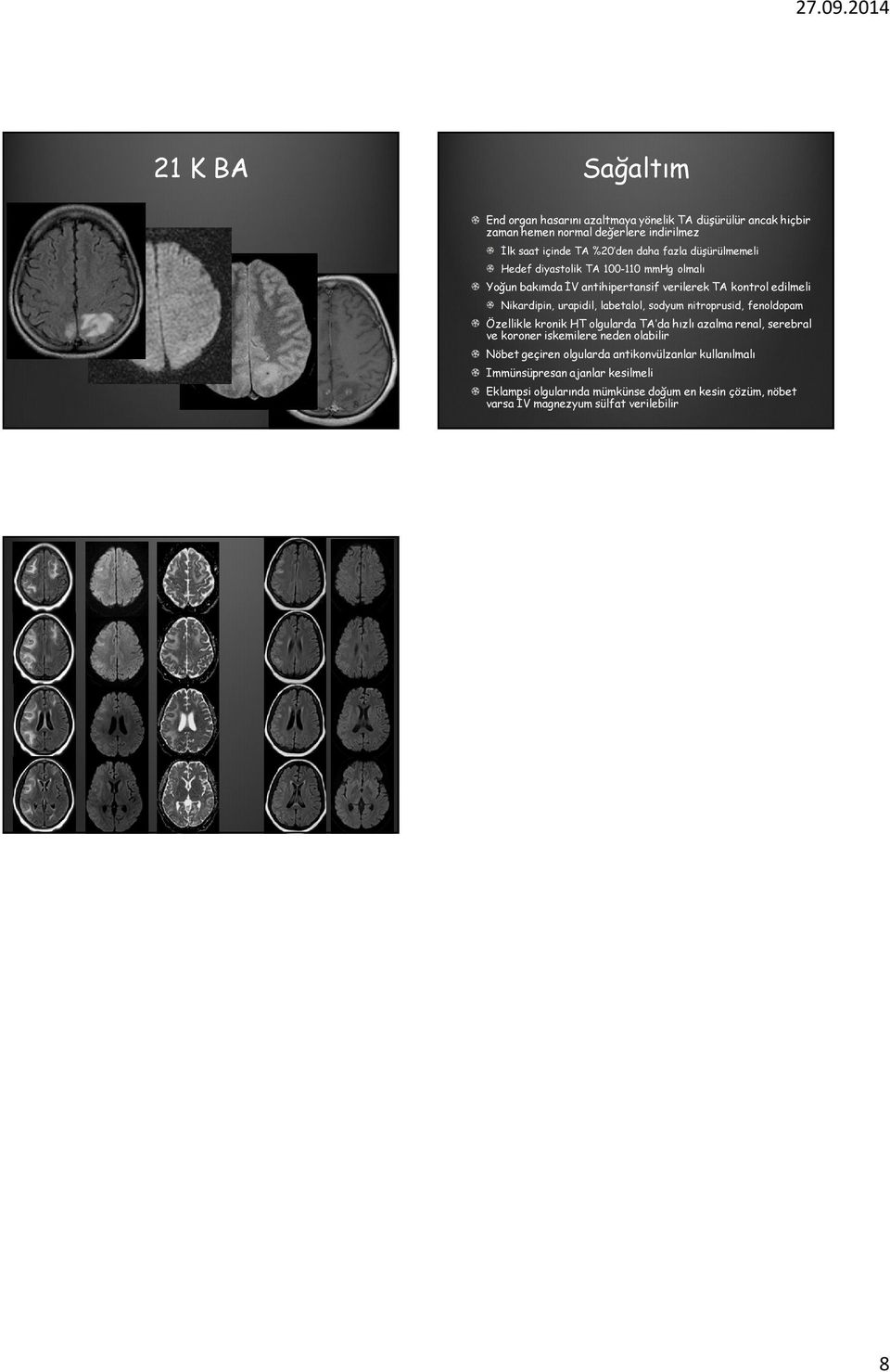 sodyum nitroprusid, fenoldopam Özellikle kronik HT olgularda TA da hızlı azalma renal, serebral ve koroner iskemilere neden olabilir Nöbet geçiren