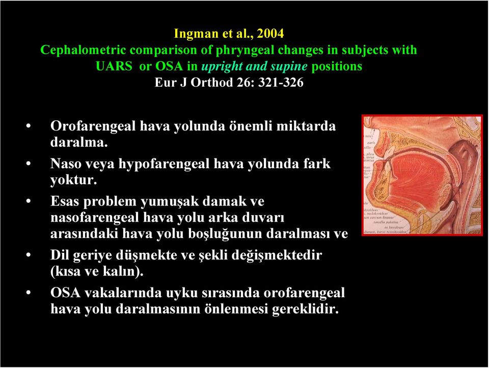 26: 321-326 Orofarengeal hava yolunda önemli miktarda daralma. Naso veya hypofarengeal hava yolunda fark yoktur.