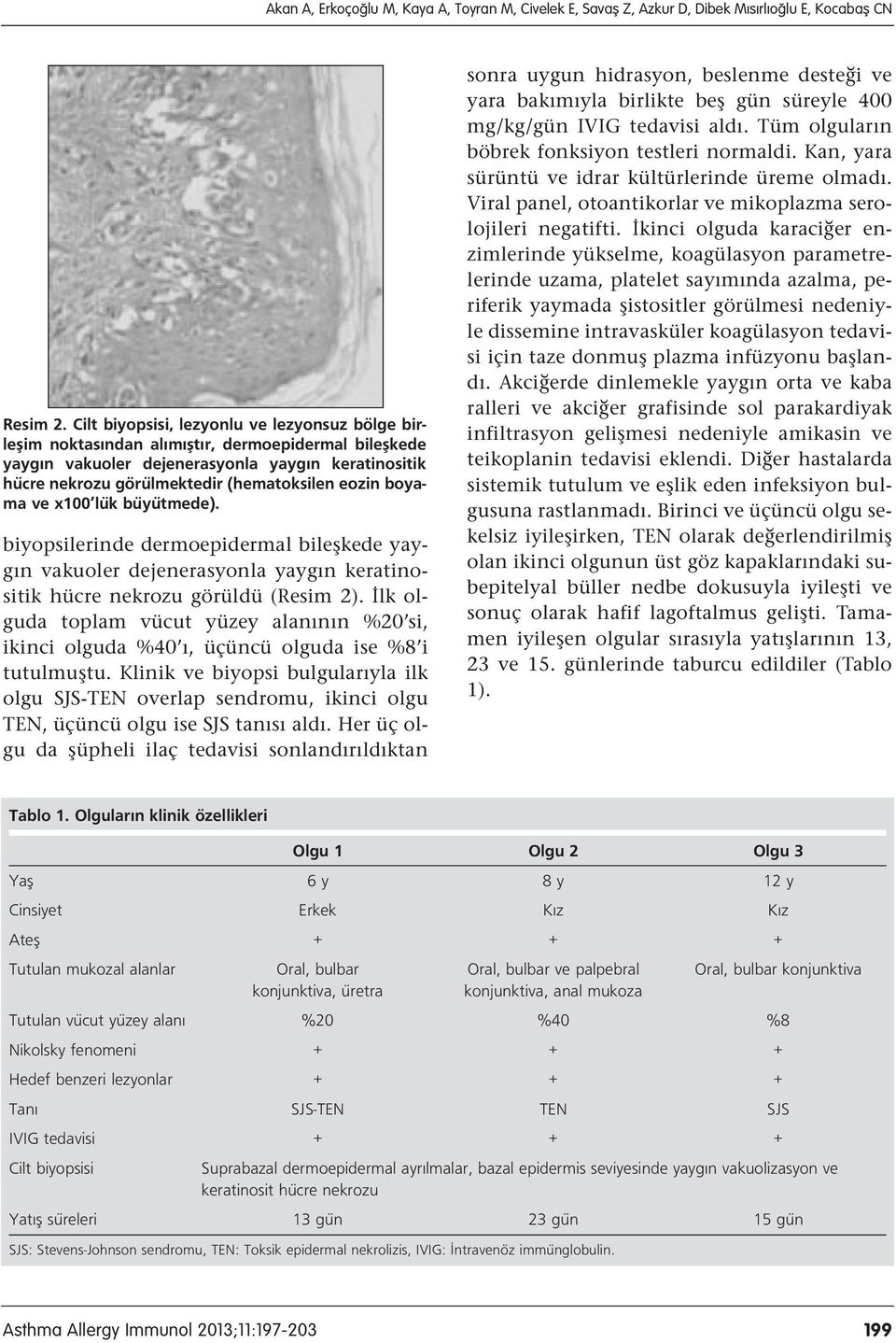 eozin boyama ve x100 lük büyütmede). biyopsilerinde dermoepidermal bileşkede yaygın vakuoler dejenerasyonla yaygın keratinositik hücre nekrozu görüldü (Resim 2).