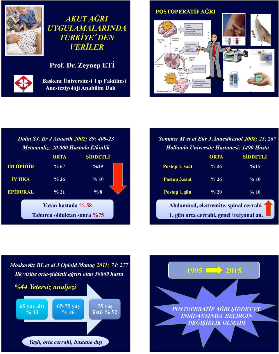 000 Hastada Etkinlik Hollanda Üniversite Hastanesi: 1490 Hasta ORTA ŞİDDETLİ ORTA ŞİDDETLİ IM OPİOİD % 67 %29 Postop 1. saat % 26 %15 İV HKA % 36 Postop 3.saat % 26 EPİDURAL % 21 %8 Postop 1.