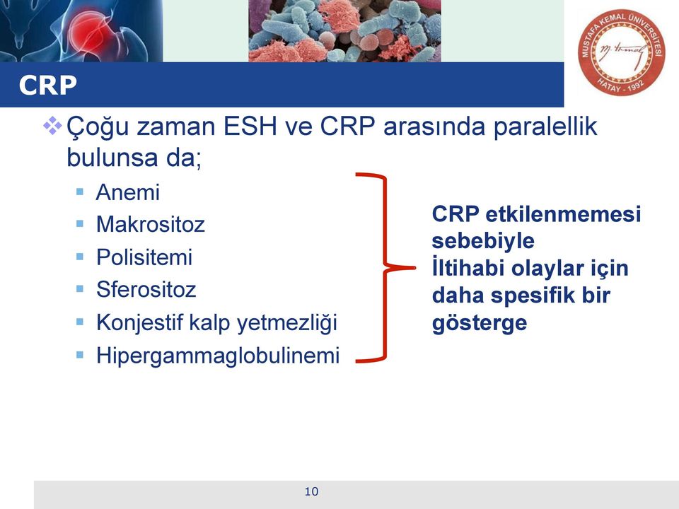 kalp yetmezliği Hipergammaglobulinemi CRP etkilenmemesi