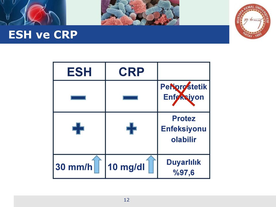 Protez Enfeksiyonu