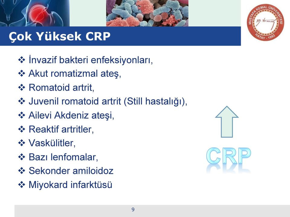 (Still hastalığı), v Ailevi Akdeniz ateşi, v Reaktif artritler,