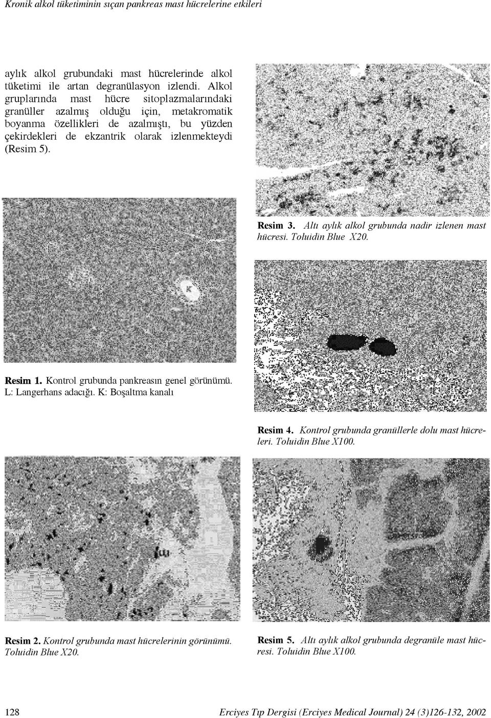 (Resim 5). Resim 3. Altı aylık alkol grubunda nadir izlenen mast hücresi. Toluidin Blue X20. Resim1.Kontrol grubunda pankreasın genel görünümü. L: Langerhans adacığı.