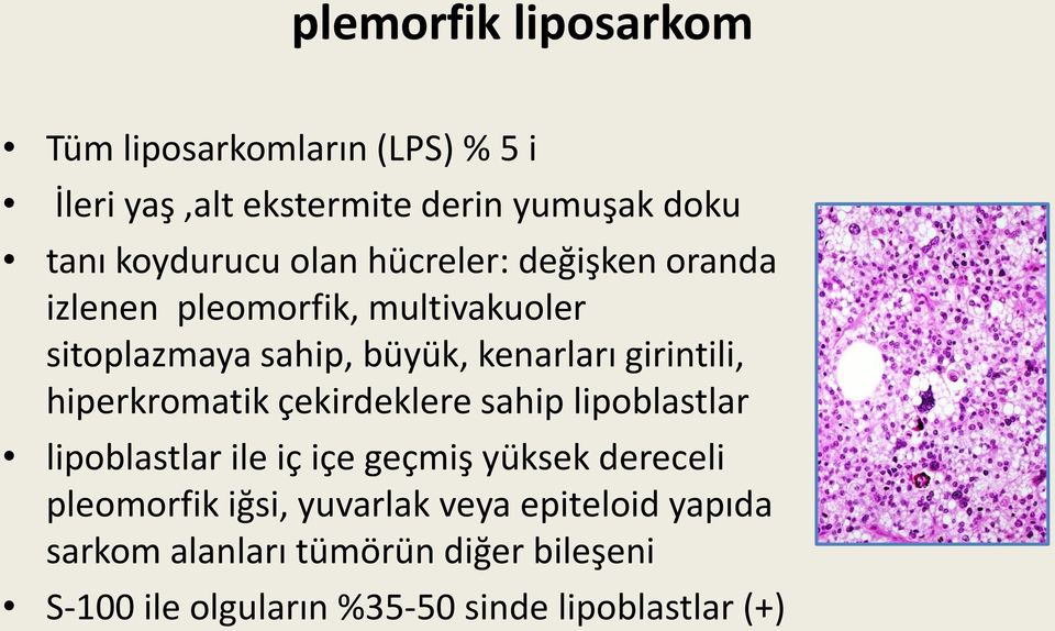 hiperkromatik çekirdeklere sahip lipoblastlar lipoblastlar ile iç içe geçmiş yüksek dereceli pleomorfik iğsi,