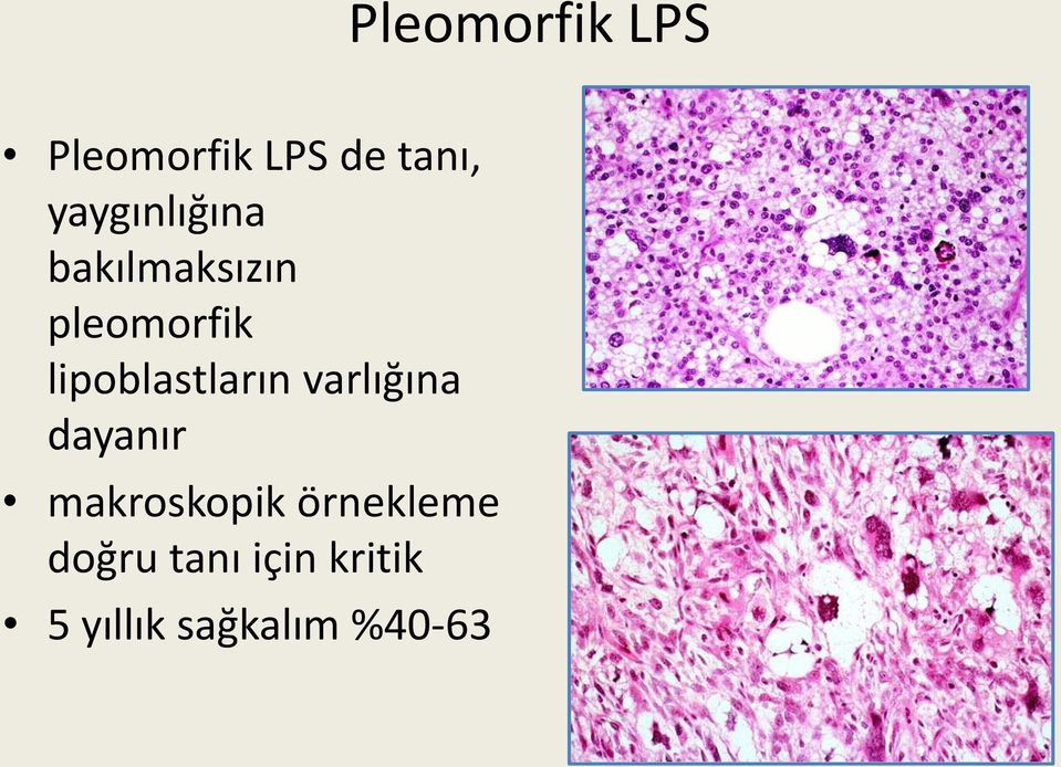 lipoblastların varlığına dayanır makroskopik