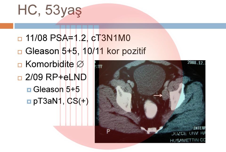 10/11 kor pozitif