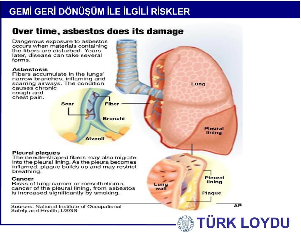 İLE