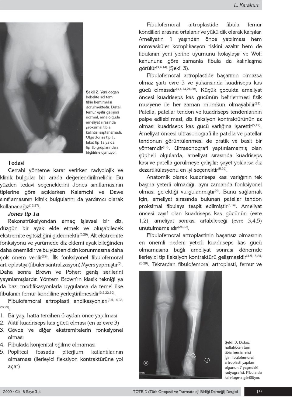 Bu yüzden tedavi seçeneklerini Jones sınıflamasının tiplerine göre açıklarken Kalamchi ve Dawe sınıflamasının klinik bulgularını da yardımcı olarak kullanacağız (12,27).