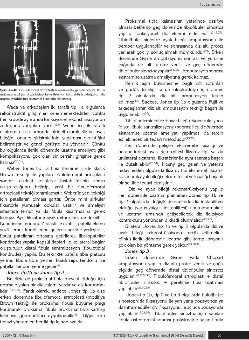 Wada ve arkadaşları iki taraflı tip 1a olgularda rekonstrüktif girişimleri önermemektedirler, çünkü her iki dizde aynı anda fonksiyonel rekonstrüksiyonun zorluğunu vurgulamışlardır (23).