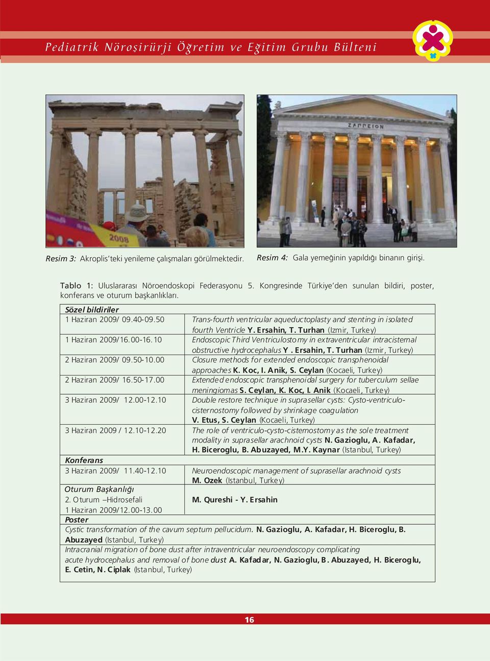 50 Trans-fourth ventricular aqueductoplasty and stenting in isolated fourth Ventricle Y. Ersahin, T. Turhan (Izmir, Turkey) 1 Haziran 2009/16.00-16.