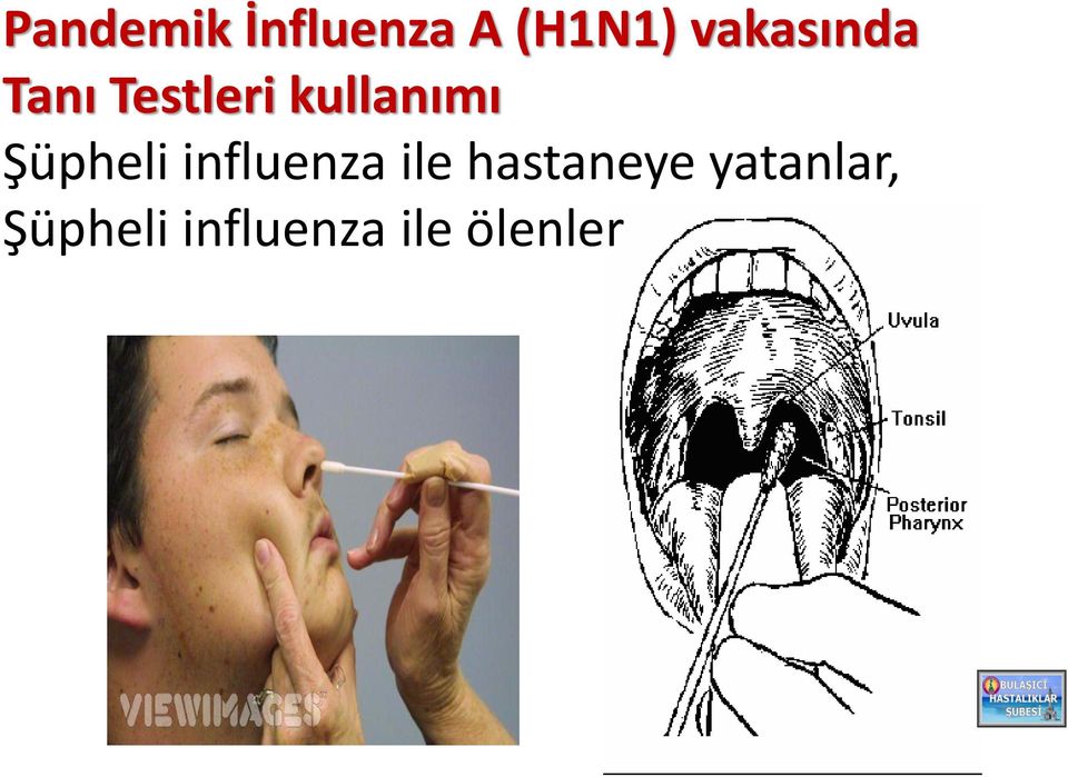 Şüpheli influenza ile hastaneye