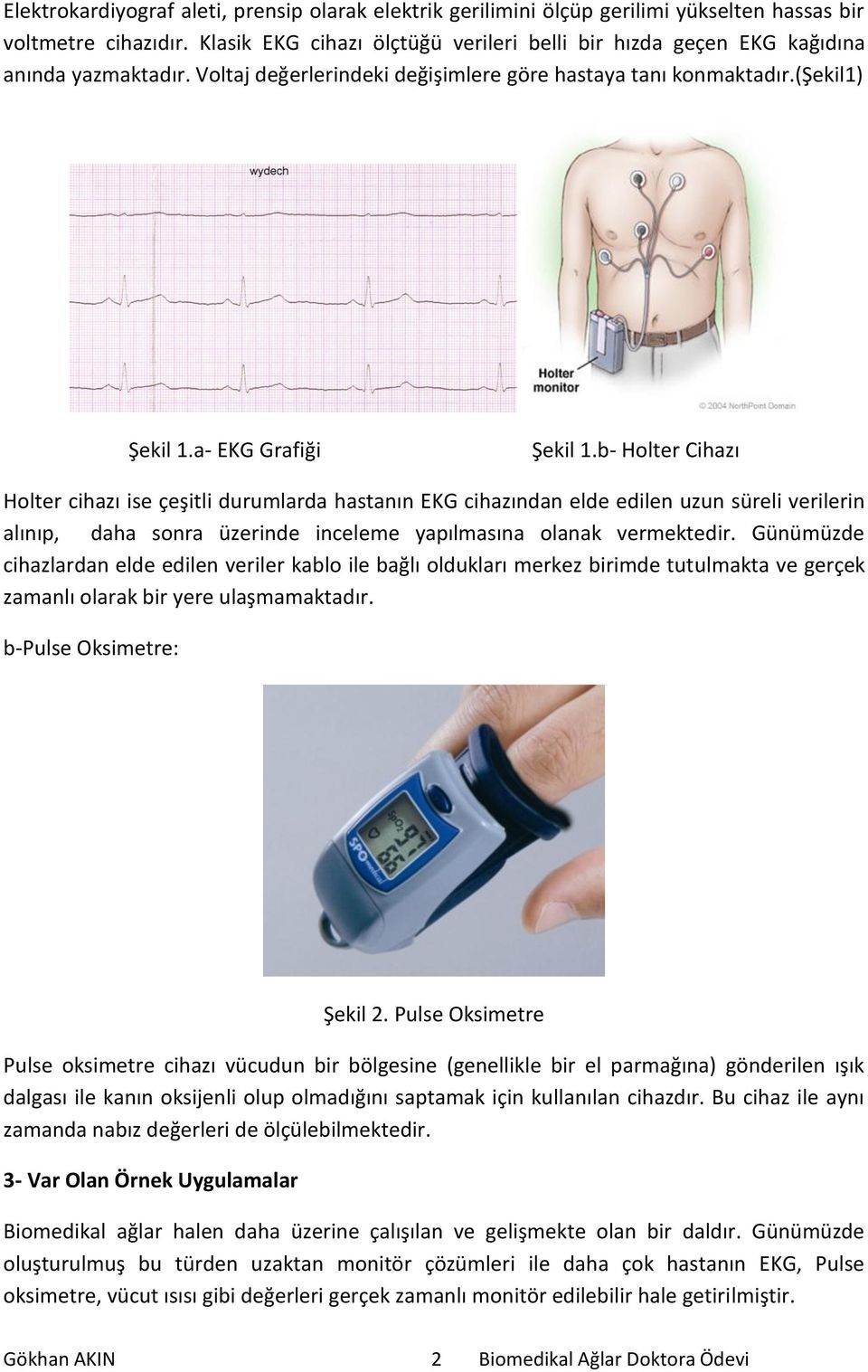 b- Holter Cihazı Holter cihazı ise çeşitli durumlarda hastanın EKG cihazından elde edilen uzun süreli verilerin alınıp, daha sonra üzerinde inceleme yapılmasına olanak vermektedir.