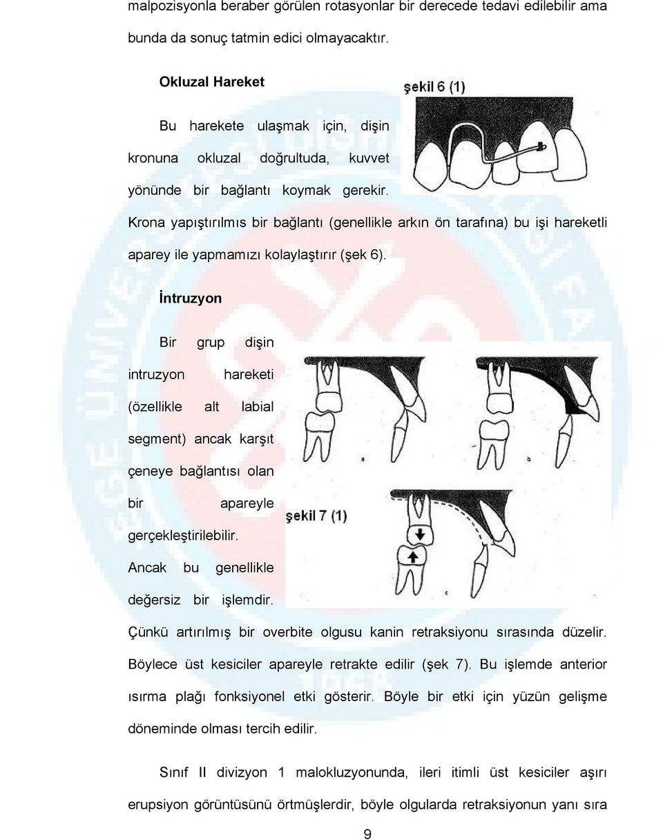 Krona yapıştırılmıs bir bağlantı (genellikle arkın ön tarafına) bu işi hareketli aparey ile yapmamızı kolaylaştırır (şek 6).