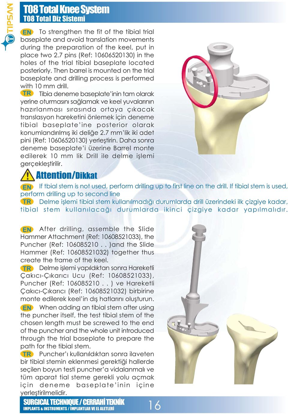 Tibia deneme baseplate inin tam olarak yerine oturmasýný saðlamak ve keel yuvalarýnýn hazýrlanmasý sýrasýnda ortaya çýkacak translasyon hareketini önlemek için deneme tibial baseplate ine posterior