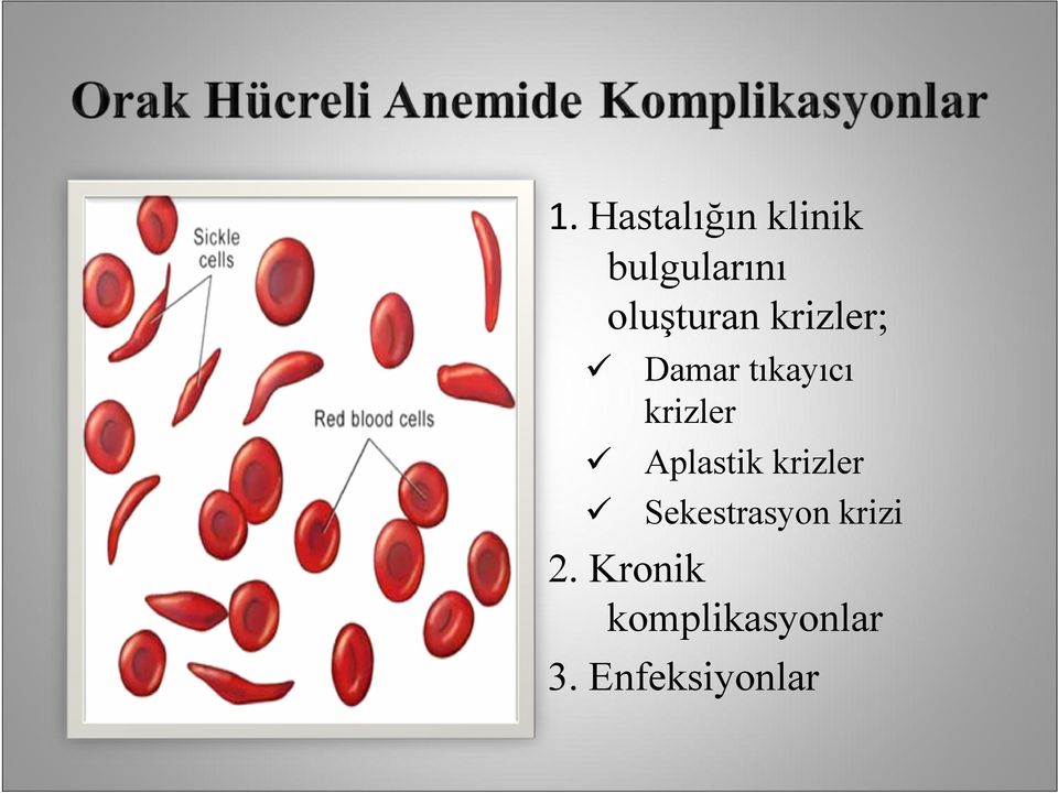 krizler Aplastik krizler Sekestrasyon