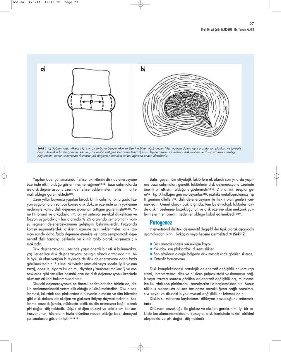 b) Disk dejenerasyonu ve internal disk rüptürü ile diskin izotropik özelli i de iflmekte, bunun sonucunda düzensiz yük da l m oluflmakta ve bel a r s na neden olmaktad r.
