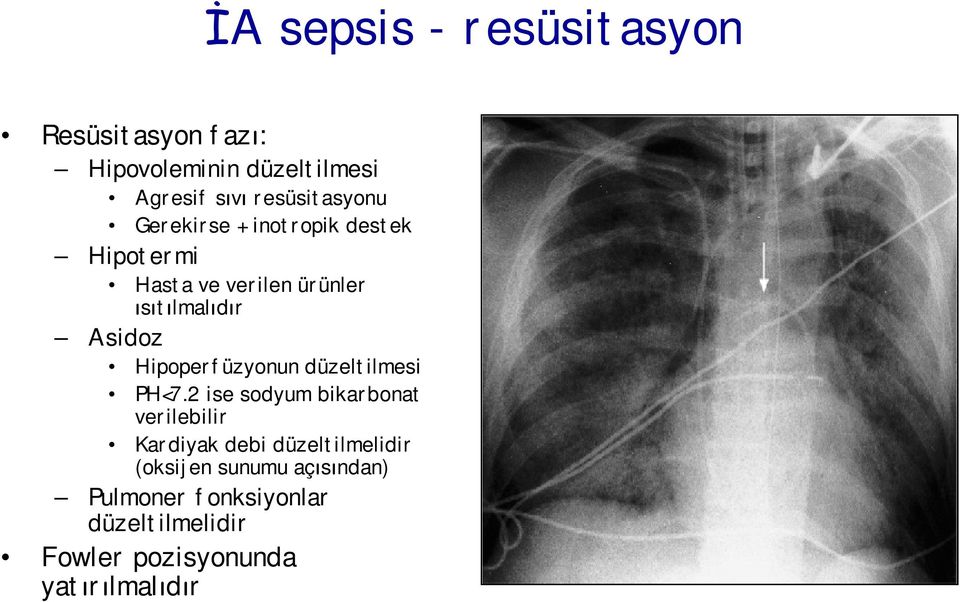 Asidoz Hipoperfüzyonun düzeltilmesi PH<7.