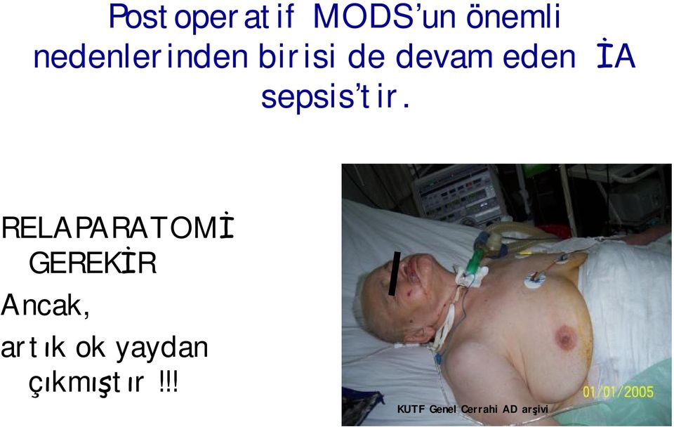 sepsis tir.