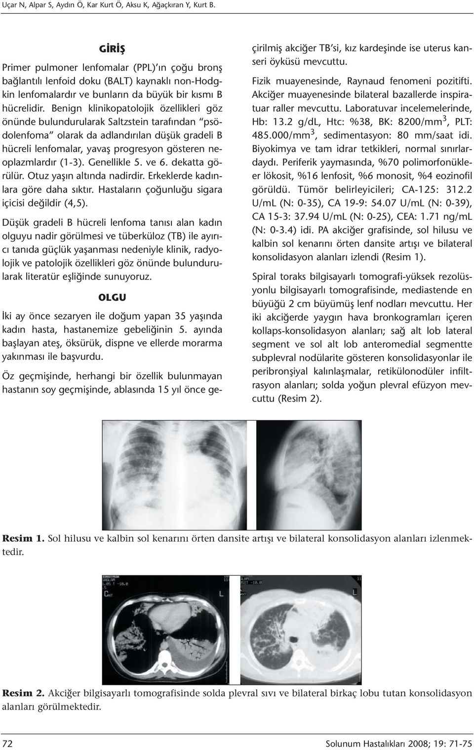 Benign klinikopatolojik özellikleri göz önünde bulundurularak Saltzstein tarafından psödolenfoma olarak da adlandırılan düşük gradeli B hücreli lenfomalar, yavaş progresyon gösteren neoplazmlardır