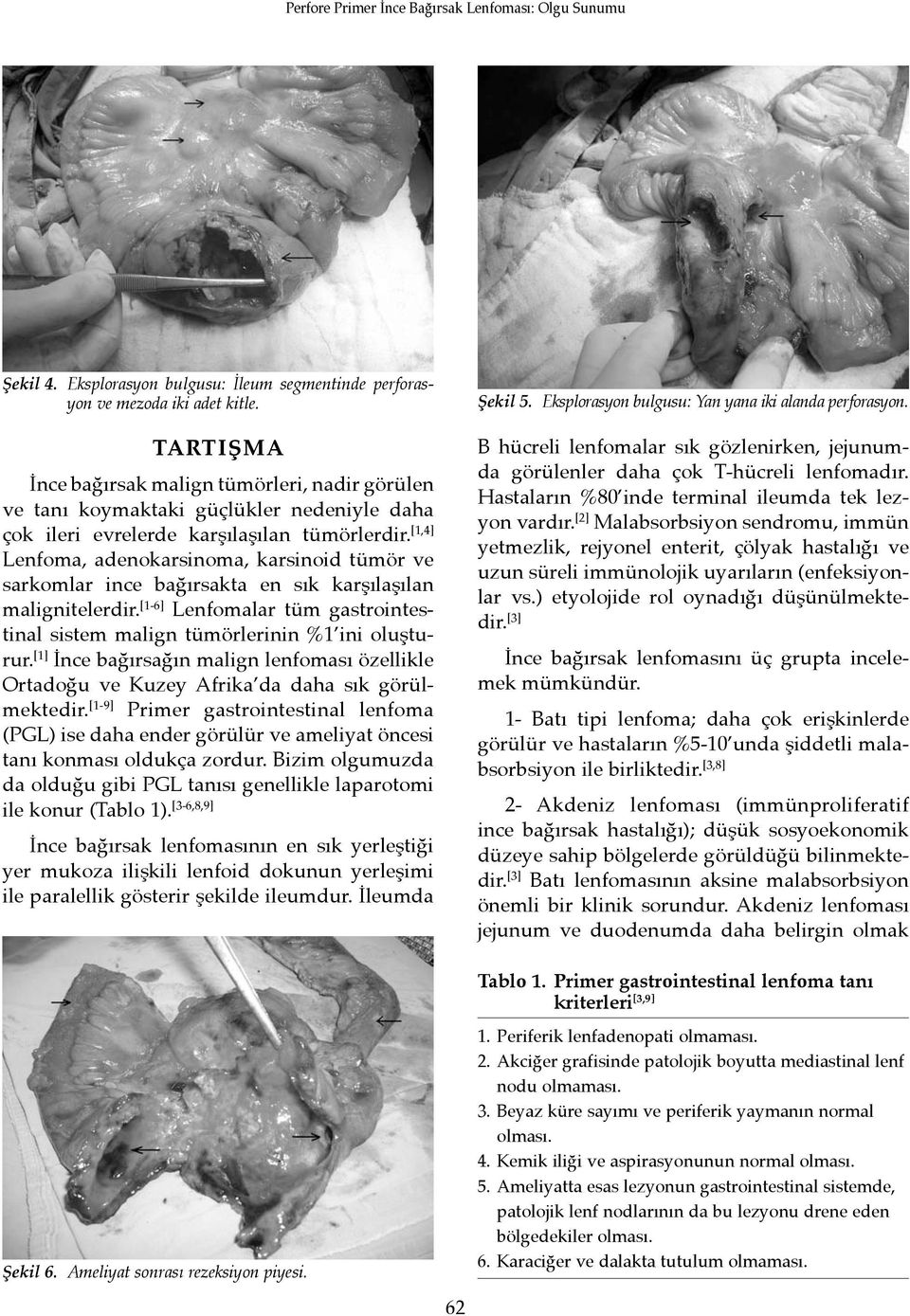 [1,4] Lenfoma, adenokarsinoma, karsinoid tümör ve sarkomlar ince bağırsakta en sık karşılaşılan malignitelerdir. [1-6] Lenfomalar tüm gastrointestinal sistem malign tümörlerinin %1 ini oluşturur.