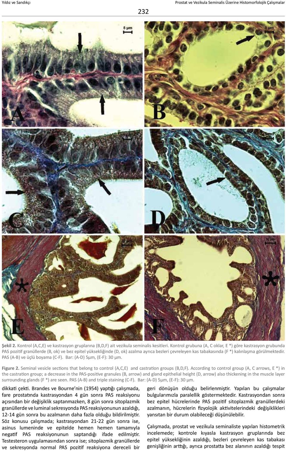 görülmektedir. PAS (A-B) ve üçlü boyama (C-F). Bar: (A-D) 5μm, (E-F): 30 μm. Figure 2. Seminal vesicle sections that belong to control (A,C,E) and castration groups (B,D,F).