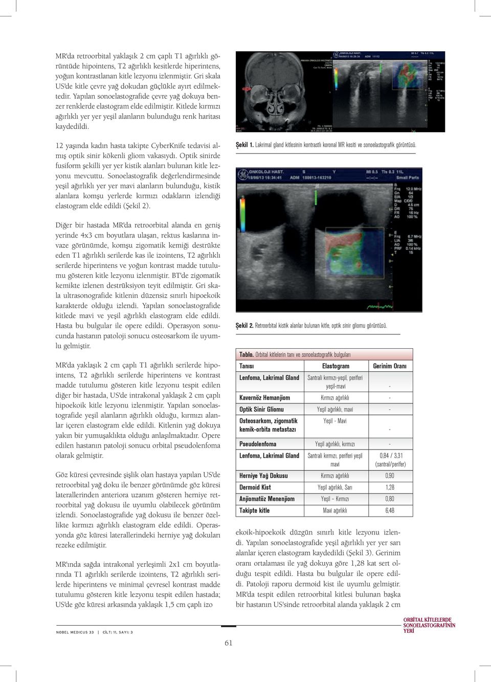 Kitlede kırmızı ağırlıklı yer yer yeşil alanların bulunduğu renk haritası kaydedildi. 12 yaşında kadın hasta takipte CyberKnife tedavisi almış optik sinir kökenli gliom vakasıydı.